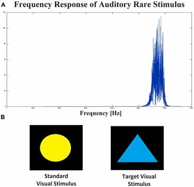 Cognitive Memory Comparison Between Tinnitus and Normal Cases Using Event-Related Potentials